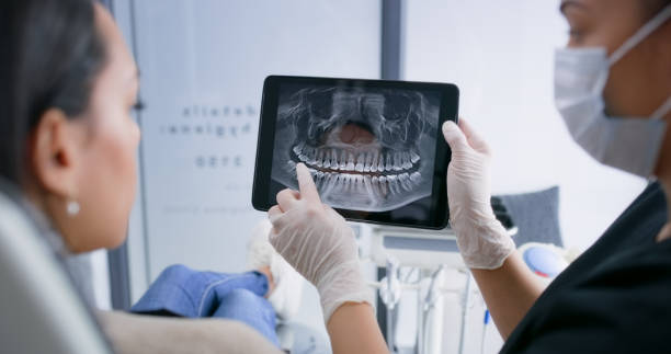 Licensed Wisdom Tooth Removal service in Oklahoma, OK - Smile Center Dentistry